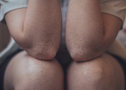 movilidad articular