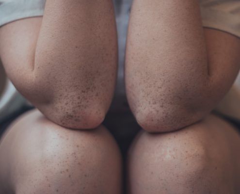 movilidad articular