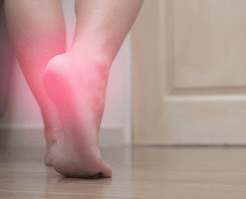 fascitis plantar dolor