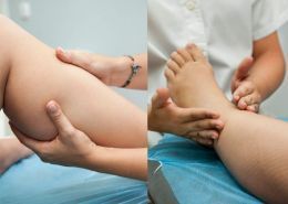 Fisioterapia integral linfática y Método Godoy para tratar el linfedema