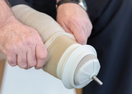 Ventajas de los liners de silicona de suspensión mediante vacío para el miembro inferior