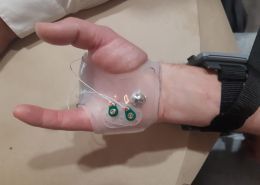 biomateriales encaje de silicona